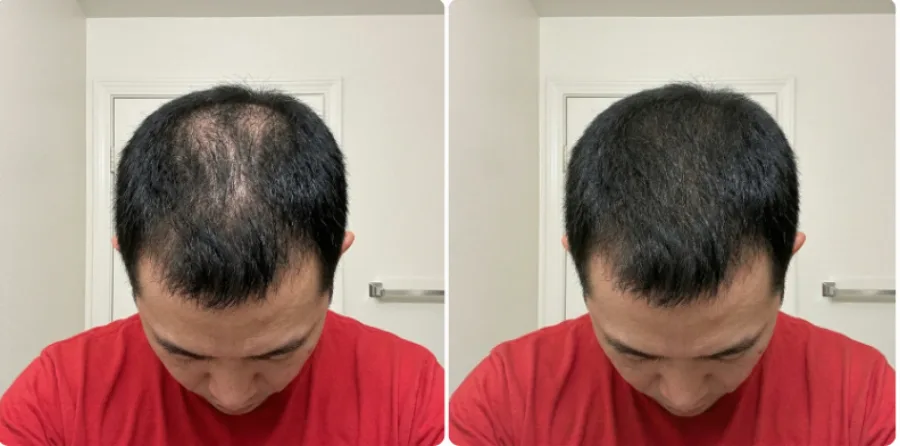 Antes y después en frente y entradas